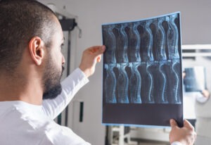 a-doctor-examining-the-x-rays-of-a-spinal-cord-injury-victim