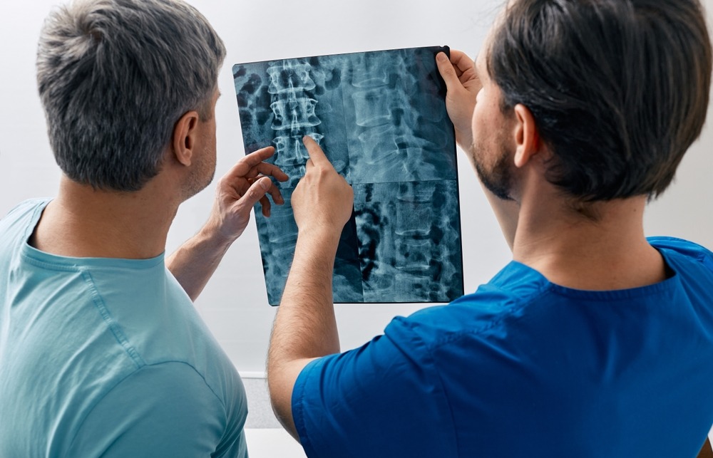 Doctors looking at a spinal cord x-ray. Work to get compensation with a South Bend spinal cord injury lawyer.